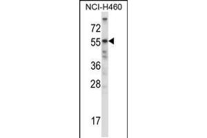 Western blot analysis in NCI-H460 cell line lysates (35ug/lane). (ACVR2B antibody  (AA 148-176))