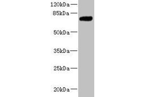 Western blot All lanes: KLHL13 antibody at 5. (KLHL13 antibody  (AA 1-260))