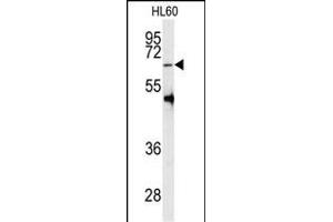 Western blot analysis of anti-PRMT5 Antibody (C-term ) (ABIN387841 and ABIN2843949) in HL60 cell line lysates (35 μg/lane). (PRMT5 antibody  (C-Term))