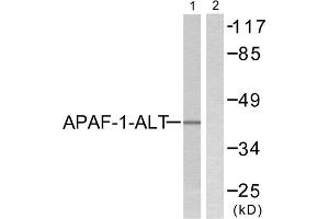 Western blot analysis of extracts from COLO205, using APAF-1-ALT antibody (ABIN5976347). (APAF1 antibody  (C-Term))