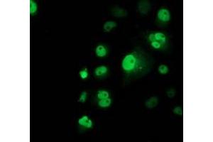 Anti-TP53 mouse monoclonal antibody (ABIN2454485) immunofluorescent staining of COS7 cells transiently transfected by pCMV6-ENTRY TP53 (RC200003). (p53 antibody)