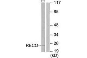 Western blot analysis of extracts from NIH-3T3 cells, using Recoverin Antibody.