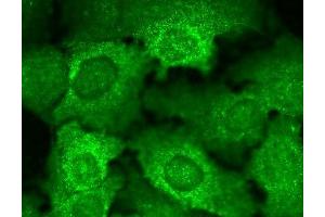 Immunocytochemistry/Immunofluorescence analysis using Mouse Anti-Cav Beta2 Calcium Channel Monoclonal Antibody, Clone S8b-1 (ABIN2485042). (CACNB2 antibody  (AA 189-205) (PerCP))
