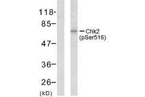 Western blot analysis of extracts from HeLa cells using Chk2 (phospho-Ser516) antibody (E011147). (CHEK2 antibody  (pSer516))