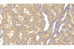 Detection of MMP8 in Human Kidney Tissue using Monoclonal Antibody to Matrix Metalloproteinase 8 (MMP8) (MMP8 antibody  (AA 101-467))