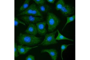 anti-Pyruvate Kinase M1/2 (PKM) (AA 475-500), (N-Term) antibody