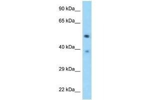 WB Suggested Anti-TSEN2 Antibody Titration: 1. (TSEN2 antibody  (C-Term))