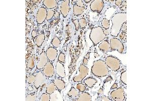 IHC analysis of U1-C/SNRPC using anti-U1-C/SNRPC antibody (ABIN7599016). (SNRPC antibody  (AA 1-159))