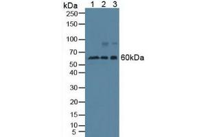 Figure. (Beclin 1 antibody  (AA 1-273))