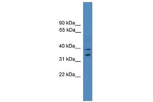 WB Suggested Anti-UFD1L Antibody Titration: 0. (UFD1L antibody  (Middle Region))