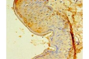 Immunohistochemistry of paraffin-embedded human skin tissue using ABIN7151448 at dilution of 1:100 (EGLN3 antibody  (AA 1-120))