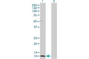 Western Blot analysis of CRABP2 expression in transfected 293T cell line by CRABP2 MaxPab polyclonal antibody. (CRABP2 antibody  (AA 1-138))