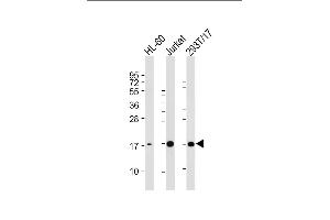 All lanes : Anti-SUMO3 Antibody at 1:2000 dilution Lane 1: HL-60 whole cell lysate Lane 2: Jurkat whole cell lysate Lane 3: 293T/17 whole cell lysate Lysates/proteins at 20 μg per lane. (SUMO3 antibody)