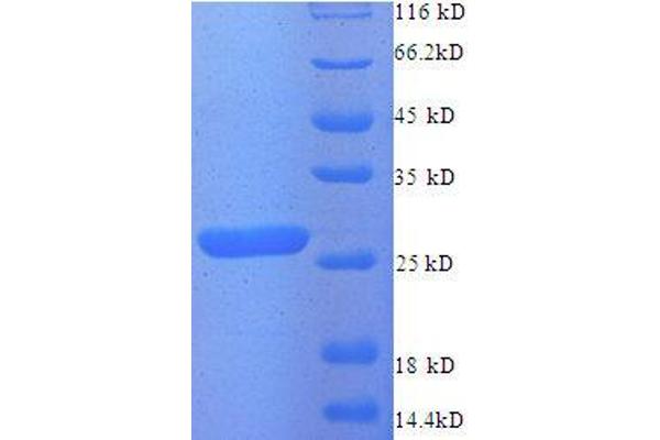 ZMAT2 Protein (AA 1-194, partial) (His tag)