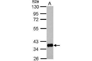 WB Image Sample (30 ug of whole cell lysate) A: Raji 10% SDS PAGE antibody diluted at 1:1000 (HLA-DPA1 antibody)