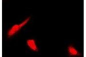 Immunofluorescent analysis of PSMB4 staining in U2OS cells. (PSMB4 antibody)