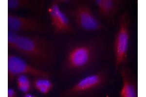 Immunofluorescence staining of methanol-fixed HeLa cells using TrkA (Phospho-Ser791) Antibody (E011326, Red) (TRKA antibody  (pSer791))