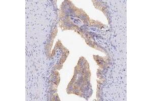Immunohistochemical staining of human prostate with TCHHL1 polyclonal antibody  shows moderate cytoplasmic positivity in glandular cells. (TCHHL1 antibody)