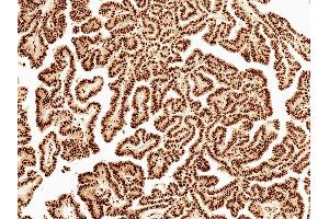 Immunohistochemistry analysis using Rabbit Anti-Wnt5a Polyclonal Antibody (ABIN5651129). (WNT5A antibody  (AA 200-300) (HRP))