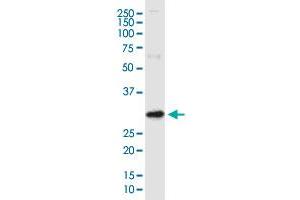 ARV1 monoclonal antibody (M01), clone 4G12. (ARV1 antibody  (AA 1-271))