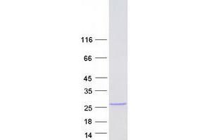 Western Blotting (WB) image for Fibroblast Growth Factor 13 (FGF13) (Transcript Variant 6) protein (Myc-DYKDDDDK Tag) (ABIN2721060)