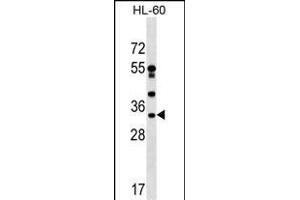 DNAJC17 Antibody (C-term) (ABIN1536940 and ABIN2849473) western blot analysis in HL-60 cell line lysates (35 μg/lane). (DNAJC17 antibody  (C-Term))