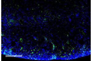 Immunohistochemistry analysis using Mouse Anti-Malondialdehyde Monoclonal Antibody, Clone 11E3 (ABIN5067376). (Malondialdehyde antibody  (PerCP))