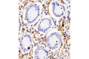 (ABIN657511 and ABIN2846535) staining RHBDF2 in human duodenum tissue sections by Immunohistochemistry (IHC-P - paraformaldehyde-fixed, paraffin-embedded sections). (RHBDF2 antibody  (N-Term))