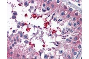 IHC testing of FFPE human testis tissue with ABCD4 antibody at 3. (ABCD4 antibody)