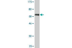 Western Blot detection against Immunogen (63. (STEAP1 antibody  (AA 1-339))