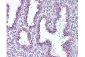 Anti-RER1 antibody IHC of human uterus. (RER1 antibody  (AA 179-192))