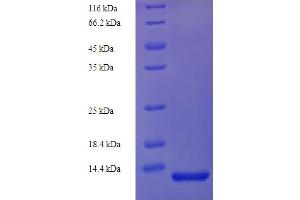 SDS-PAGE (SDS) image for CD81 (CD81) (AA 113-201) protein (His tag) (ABIN4974272)