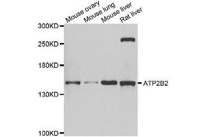Western blot analysis of extracts of various cell lines, using ATP2B2 antibody.