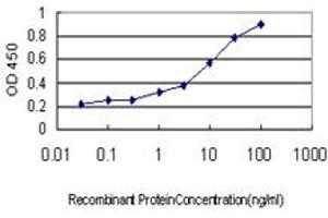 Detection limit for recombinant GST tagged DHODH is approximately 0. (DHODH antibody  (AA 32-140))
