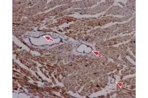 Expression of RyR2 in rat cardiac muscle - Immunohistochemical staining of paraffin-embedded sections of rat myocardium using Anti-Ryanodine Receptor 2 Antibody (ABIN7043605, ABIN7045213 and ABIN7045214), (1:50). (RYR2 antibody  (Intracellular))