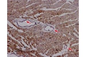 Expression of RyR2 in rat cardiac muscle - Immunohistochemical staining of paraffin-embedded sections of rat myocardium using Anti-Ryanodine Receptor 2 Antibody (ABIN7043605, ABIN7045213 and ABIN7045214), (1:50).