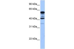 Western Blotting (WB) image for anti-Family with Sequence Similarity 46, Member C (FAM46C) antibody (ABIN2463600) (FAM46C antibody)