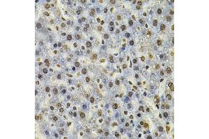 Immunohistochemistry of paraffin-embedded rat liver using IFI16 Antibody (ABIN6129036, ABIN6142162, ABIN6142163 and ABIN6218202) at dilution of 1:100 (40x lens). (IFI16 antibody  (AA 1-300))