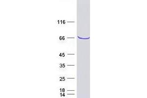 Validation with Western Blot