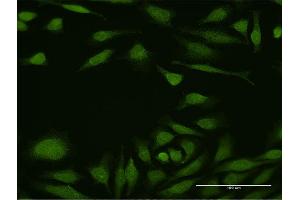 Immunofluorescence of purified MaxPab antibody to DEAF1 on HeLa cell. (DEAF1 antibody  (AA 1-565))