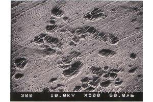 Immunohistochemistry (IHC) image for Osteoclast (Rat) Culture Kit (ABIN956046) (Osteoclast (Rat) Culture Kit)