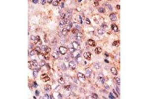 Image no. 2 for anti-ATP-Binding Cassette, Sub-Family B (MDR/TAP), Member 7 (ABCB7) (C-Term) antibody (ABIN358593) (ABCB7 antibody  (C-Term))