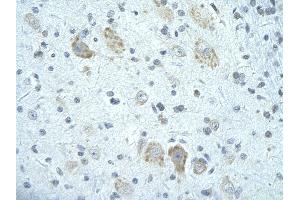 Rabbit Anti-FIP1L1 antibody        Paraffin Embedded Tissue:  Human Brain cell   Cellular Data:  Epithelial cells of renal tubule  Antibody Concentration:   4.