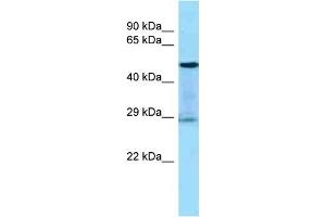 Host:  Rabbit  Target Name:  KLK3  Sample Tissue:  Human THP-1 Whole Cell  Antibody Dilution:  1ug/ml (Prostate Specific Antigen antibody  (Middle Region))