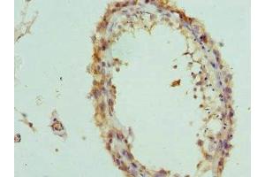 Immunohistochemistry of paraffin-embedded human testis tissue using ABIN7156846 at dilution of 1:100 (IL-2 antibody  (AA 25-176))
