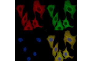 ADAM9 Mouse Monoclonal Antibody staining HepG2 cells by IF/ICC.