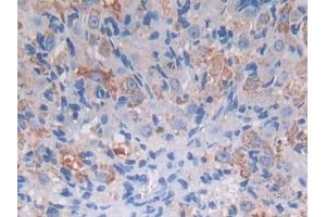 DAB staining on IHC-P; Samples: Mouse Ovary Tissue (PROZ antibody  (AA 23-399))