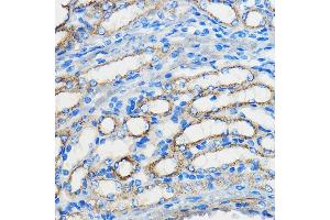 Immunohistochemistry (IHC) image for anti-Activating Transcription Factor 6 (ATF6) (AA 1-190) antibody (ABIN1512605)