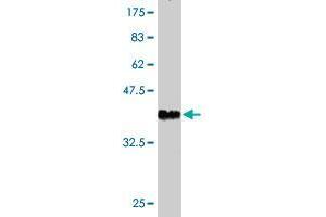 Western Blot detection against Immunogen (36. (LRIG3 antibody  (AA 1020-1119))