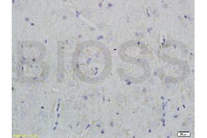 Formalin-fixed and paraffin embedded rat brain tissue labeled with Rabbit Anti-Nociceptin receptor Polyclonal Antibody (ABIN725960) at 1:200 followed by conjugation to the secondary antibody and DAB staining. (OPRL1 antibody  (AA 1-47))